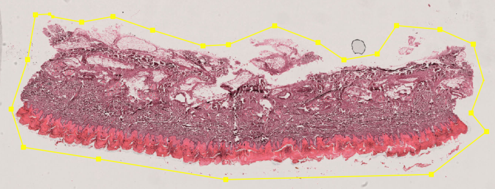 Polygon annotation drawn around tissue in QuPath