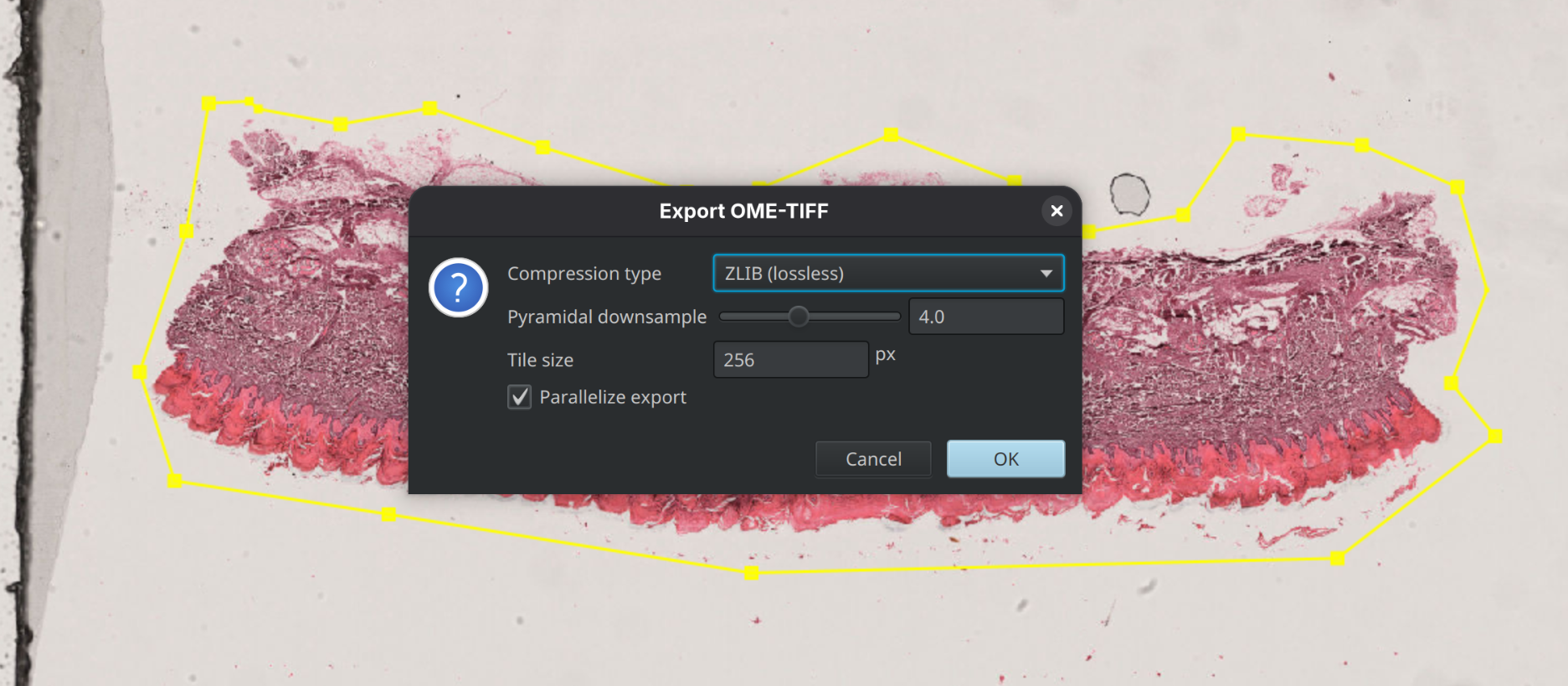 Exporting annotated region as OME-TIFF